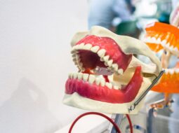3D Printed Teeth