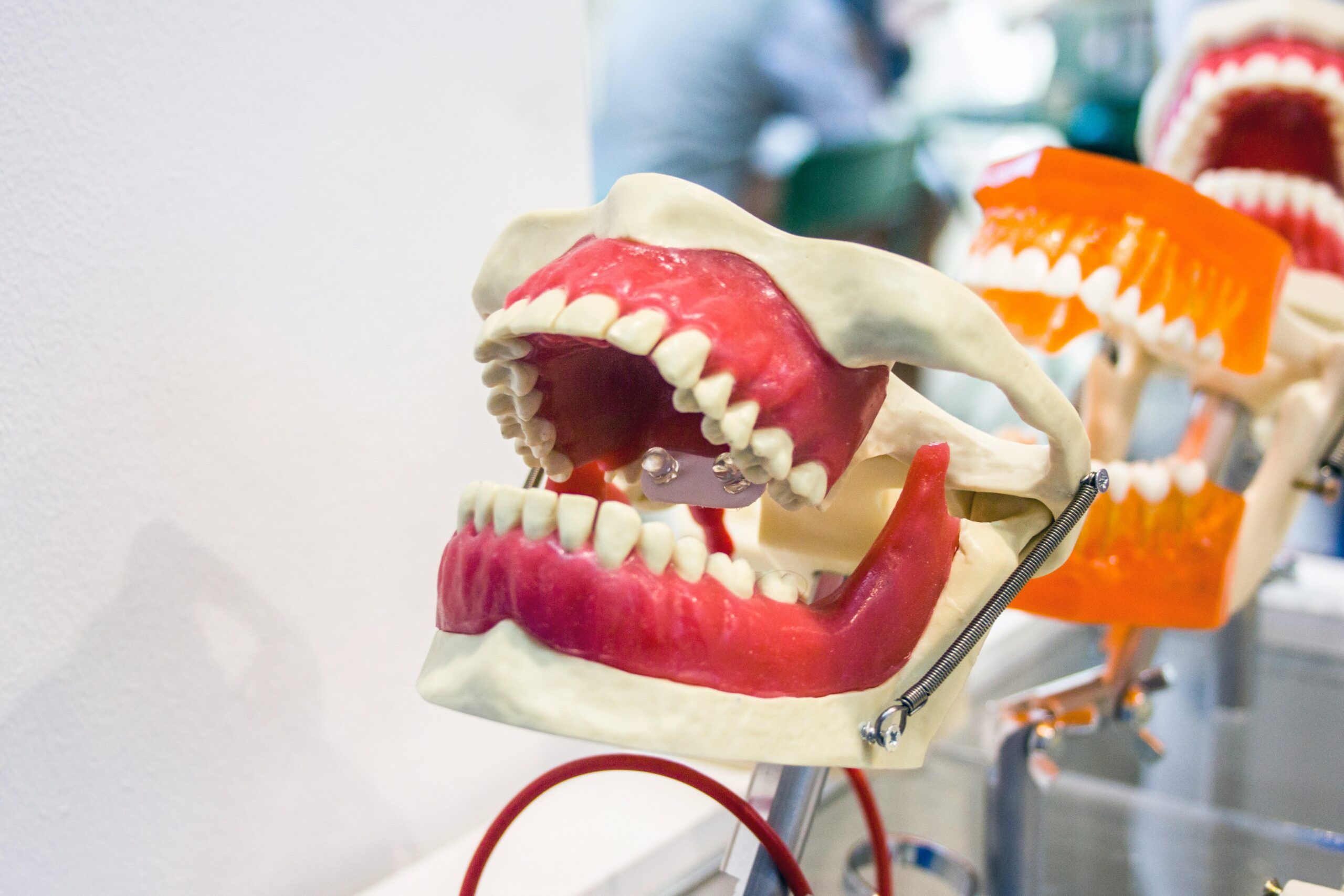 3D Printed Teeth
