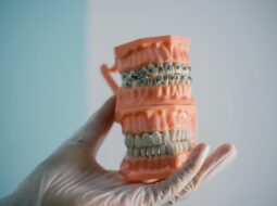 The Future of Dentistry Exploring the Impact of 3D Printed Teeth on Patient Care